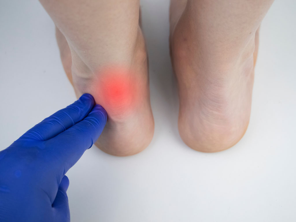 Genou: Le talon d’Achille des danseurs