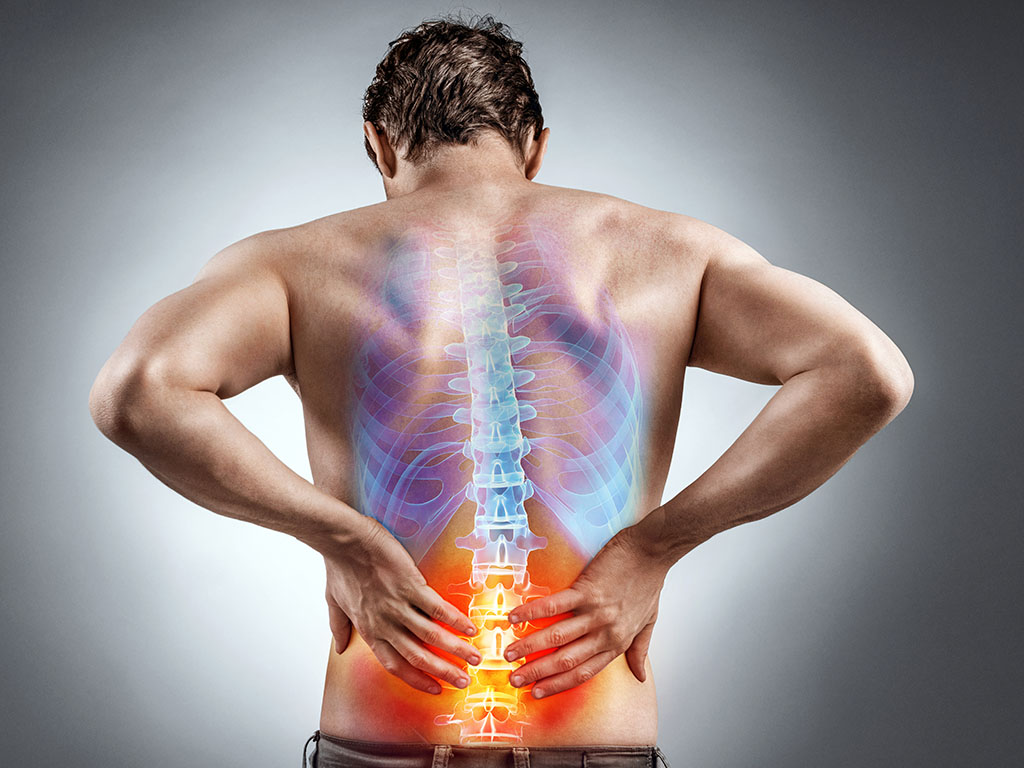 Des conseils pour contrer la sciatique